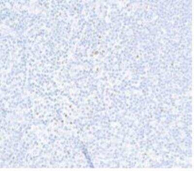 Immunohistochemistry-Paraffin: FoxP3 Antibody (BLR034F) [NBP3-14670]