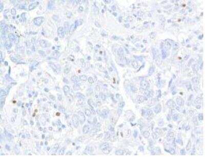 Immunohistochemistry-Paraffin: FoxP3 Antibody (BLR034F) [NBP3-14670]