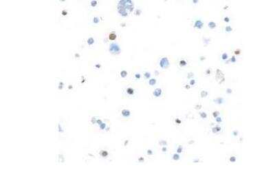 Immunohistochemistry: FoxP3 Antibody (BLR034F) [NBP3-14670]