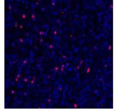 Immunohistochemistry: FoxP3 Antibody (BLR034F) [NBP3-14670]