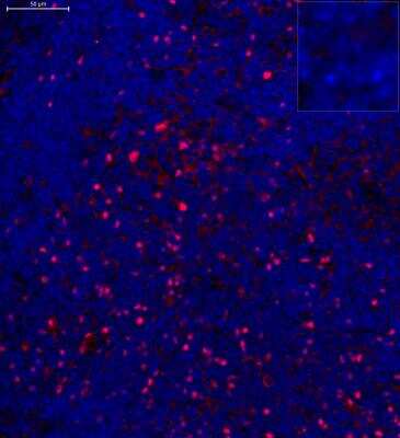 Immunohistochemistry-Paraffin: FoxP3 Antibody - BSA Free [NB100-39002]