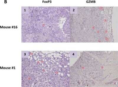 Immunohistochemistry-Paraffin: FoxP3 Antibody - BSA Free [NB100-39002]