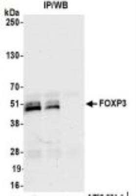Immunoprecipitation: FoxP3 Antibody (BLR034F) [NBP3-14670]