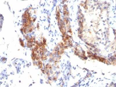 Immunohistochemistry-Paraffin: FoxP3 Antibody (SPM579) - Azide and BSA Free [NBP2-34432]