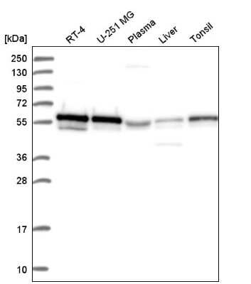 Western Blot: FoxP3 Antibody [NBP2-58697]