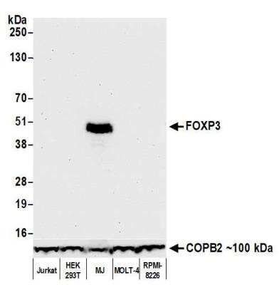 Western Blot: FoxP3 Antibody (BLR034F) [NBP3-14670]