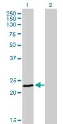 Western Blot: Frataxin Antibody (3G9) [H00002395-M03]