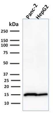 Western Blot: Frataxin Antibody (FXN/2124) [NBP2-79802]