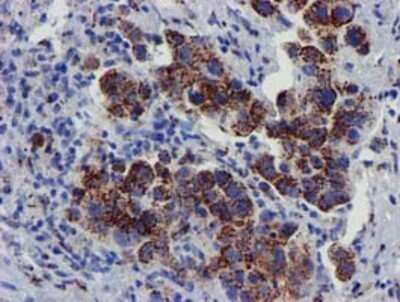 Immunohistochemistry: Frataxin Antibody (OTI1C12) - Azide and BSA Free [NBP2-70766]