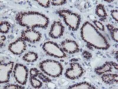 Immunohistochemistry: Frataxin Antibody (OTI1C12) - Azide and BSA Free [NBP2-70766]