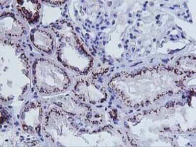 Immunohistochemistry: Frataxin Antibody (OTI1C12) - Azide and BSA Free [NBP2-70766]