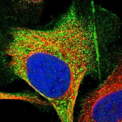 Immunocytochemistry/ Immunofluorescence: Frequenin Antibody [NBP1-89820]