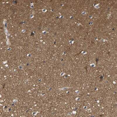 Immunohistochemistry-Paraffin: Frequenin Antibody [NBP1-89820]