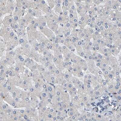 Immunohistochemistry-Paraffin: Frequenin Antibody [NBP1-89820]
