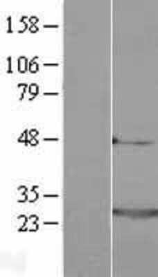Western Blot: Frequenin Overexpression Lysate [NBL1-10831]