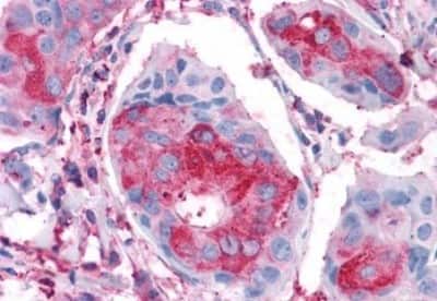 Immunohistochemistry: Frizzled-1 Antibody [NBP3-14324]