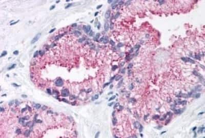 Immunohistochemistry-Paraffin: Frizzled-1 Antibody [NBP3-14324]