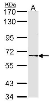 Western Blot: Frizzled-10 Antibody [NBP2-16532]