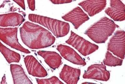 Immunohistochemistry-Paraffin: Frizzled-3 Antibody [NBP3-14325]