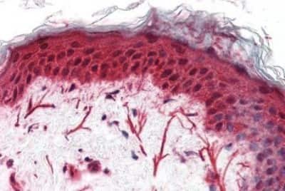 Immunohistochemistry-Paraffin: Frizzled-3 Antibody [NBP3-14325]