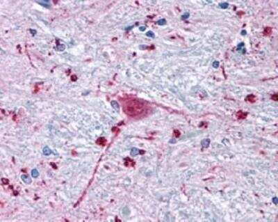 Immunohistochemistry-Paraffin: Frizzled-3 Antibody - BSA Free [NLS4437]