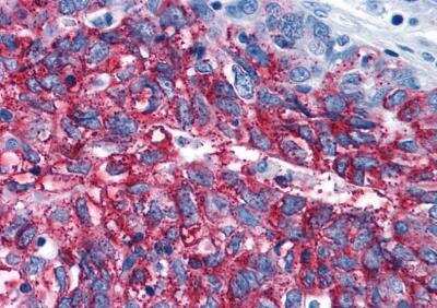 Immunohistochemistry-Paraffin: Frizzled-3 Antibody - BSA Free [NLS4437]