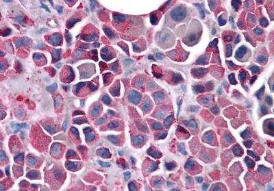 Immunohistochemistry-Paraffin: Frizzled-3 Antibody - BSA Free [NLS4437]