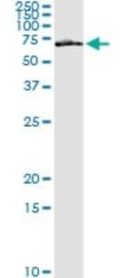 Immunoprecipitation: Frizzled-5 Antibody (6A3) [H00007855-M01]
