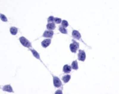 Immunohistochemistry-Paraffin: Frizzled-6 Antibody - BSA Free [NLS4482]