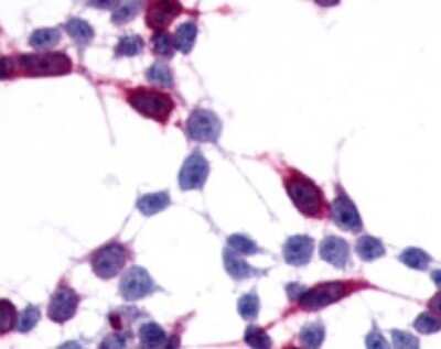 Immunohistochemistry-Paraffin: Frizzled-6 Antibody - BSA Free [NLS4482]