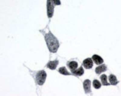 Immunohistochemistry-Paraffin: Frizzled-6 Antibody - BSA Free [NLS4482]
