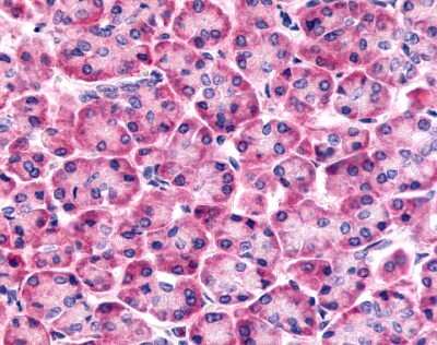 Immunohistochemistry-Paraffin: Frizzled-6 Antibody - BSA Free [NLS4482]