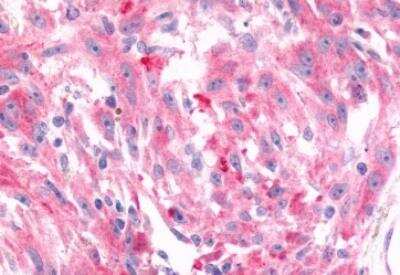 Immunohistochemistry-Paraffin: Frizzled-6 Antibody - BSA Free [NLS4482]