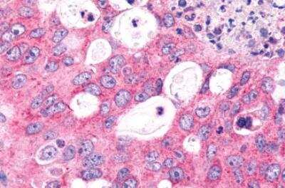 Immunohistochemistry-Paraffin: Frizzled-6 Antibody - BSA Free [NLS4482]