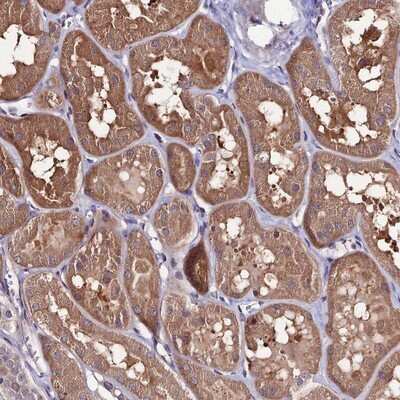 Immunohistochemistry-Paraffin: Frizzled-8 Antibody [NBP1-87410]