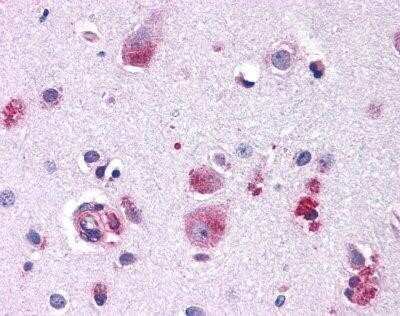 Immunohistochemistry-Paraffin: Frizzled-9 Antibody - BSA Free [NLS5097]