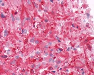 Immunohistochemistry-Paraffin: Frizzled-9 Antibody - BSA Free [NLS5097]