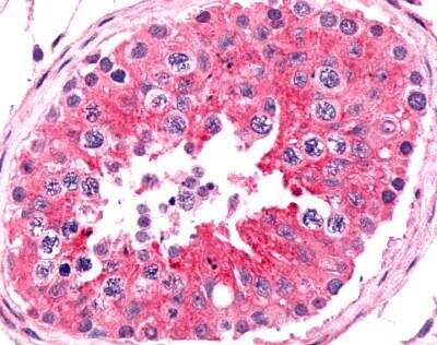 Immunohistochemistry-Paraffin: Frizzled-9 Antibody - BSA Free [NLS5103]
