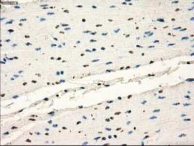 Immunohistochemistry: Frk Antibody (OTI6D2) - Azide and BSA Free [NBP2-70775]