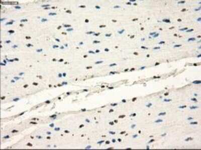 Immunohistochemistry-Paraffin: Frk Antibody (OTI6D2) [NBP1-47761]