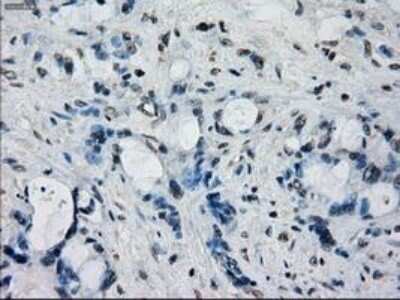 Immunohistochemistry-Paraffin: Frk Antibody (OTI6D2) [NBP1-47761]
