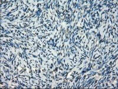 Immunohistochemistry-Paraffin: Frk Antibody (OTI6D2) [NBP1-47761]