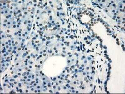 Immunohistochemistry-Paraffin: Frk Antibody (OTI6D2) [NBP1-47761]