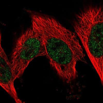 Immunocytochemistry/ Immunofluorescence: Fructosamine-3-kinase-related Antibody [NBP2-55370]