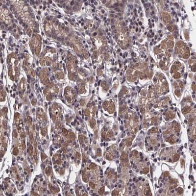 Immunohistochemistry: Fructosamine-3-kinase-related Antibody [NBP2-39063]