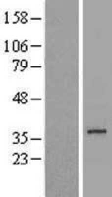 Western Blot: Fructosamine-3-kinase-related Overexpression Lysate [NBL1-10781]