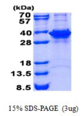 SDS-PAGE: Recombinant Human Fructosamine-3-kinase-related His Protein [NBP2-23060]
