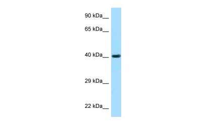 Western Blot: Fucosyltransferase 3/FUT3 Antibody [NBP1-98489]