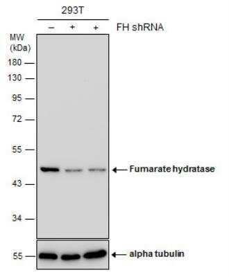 Western Blot: Fumarase Antibody (7612) [NBP2-43578]