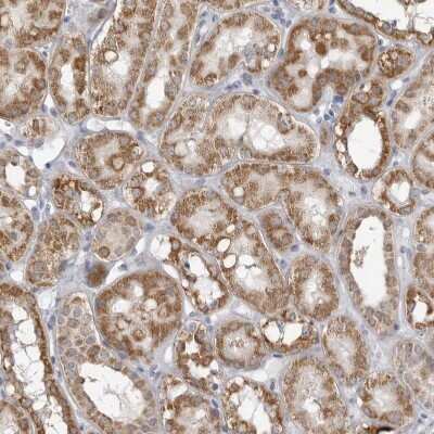 Immunohistochemistry-Paraffin: Fumarase Antibody [NBP1-89815]